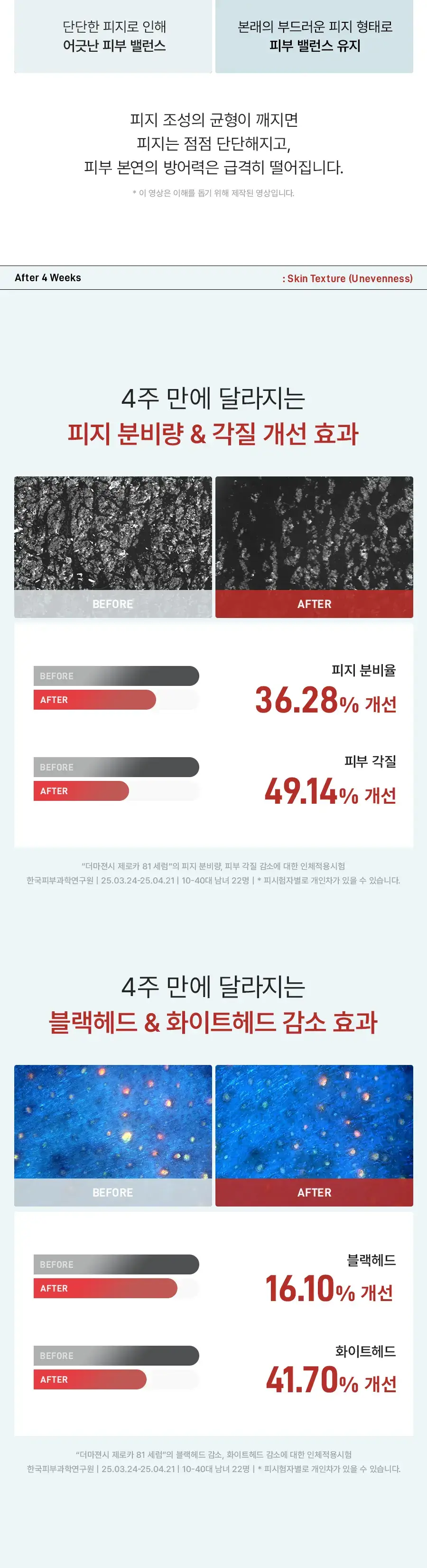[트러블OUT세럼] 더마젼시 제로카 81 세럼 30ml 상세페이지 13